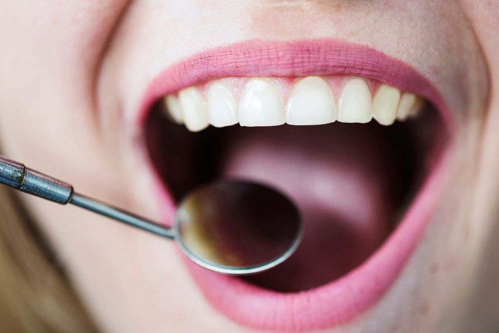 Denti demineralizzati: sintomi, cause e cure